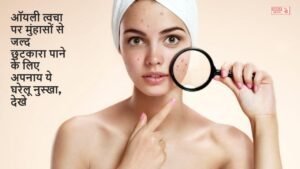 Skin Tips: ऑयली त्वचा पर मुंहासों से जल्द छुटकारा पाने के लिए अपनाय ये घरेलू नुस्खा, देखे